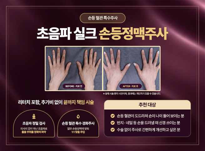 초음파 실크 손등정맥주사