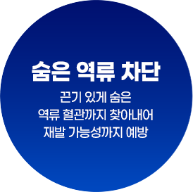 숨은 역류 차단 : 끈기 있게 숨은 역류 혈관까지 찾아내어 재발 가능성까지 예방