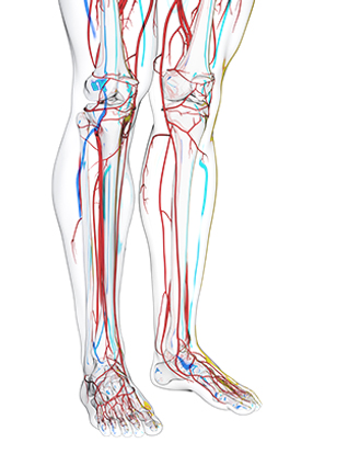 재발 예방을 위한 광역 혈관치료