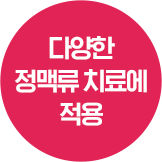 다양한 정맥류 치료에 적용